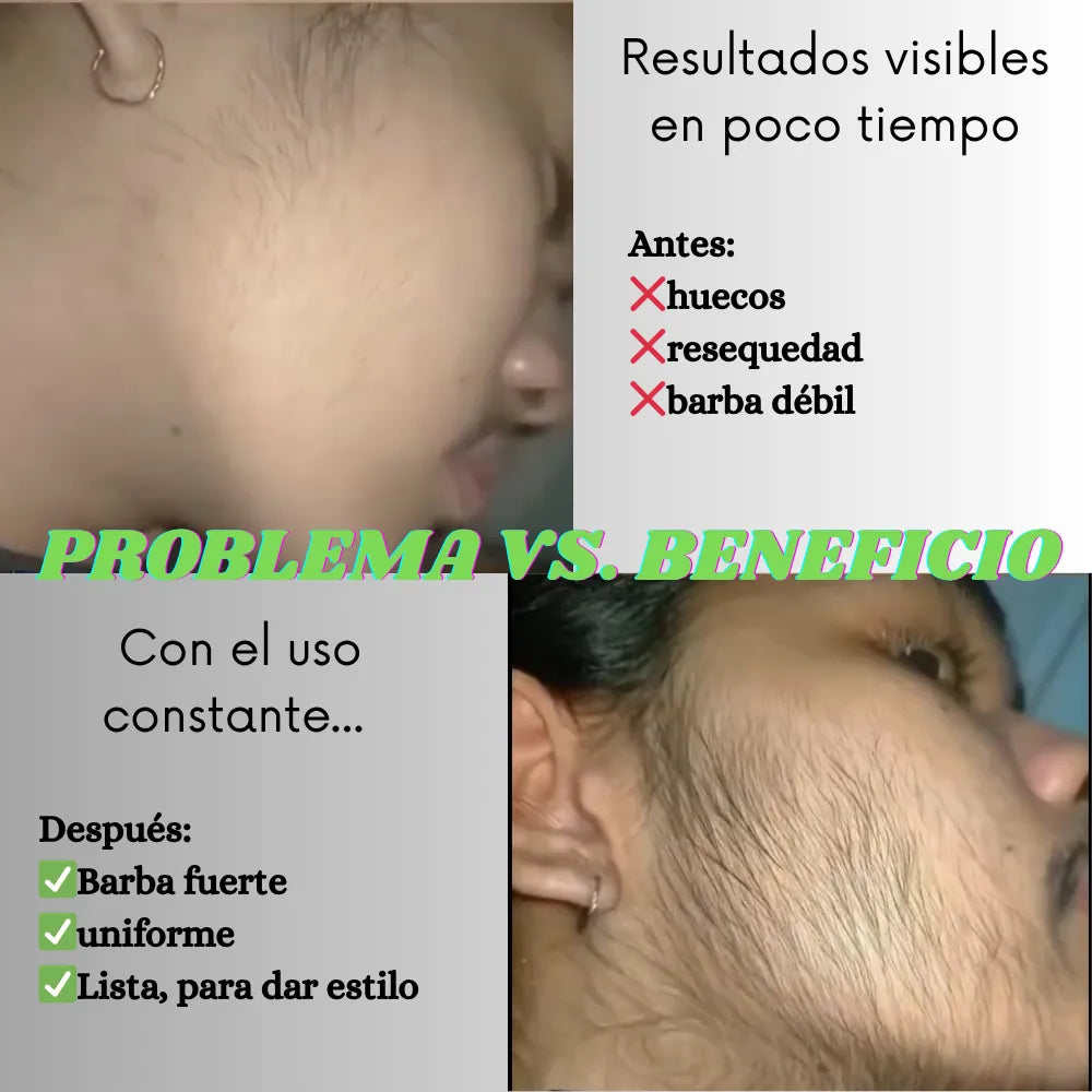 Growing Aceite Barba + 🎁 Suero Facial Hidratante