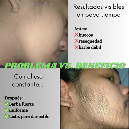 Growing Aceite Barba + 🎁 Suero Facial Hidratante