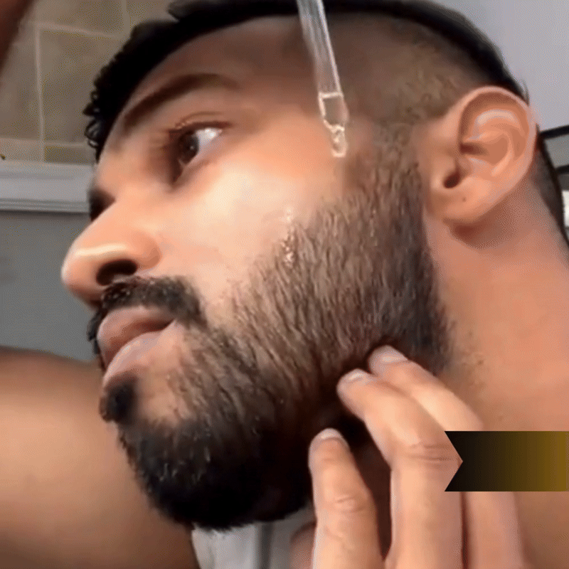 Growing Aceite Barba + 🎁 Suero Facial Hidratante